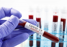 بیماری COVID-19