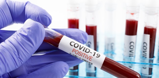 بیماری COVID-19